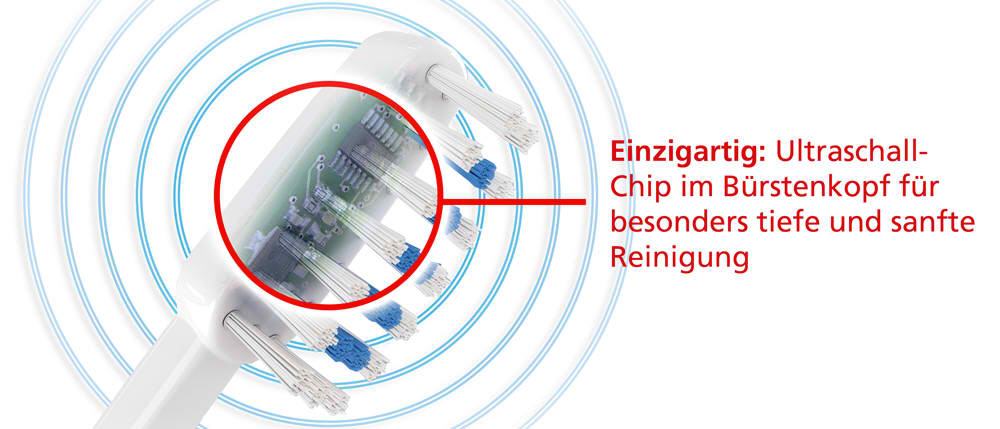 Das Wirkprinzip der Ultraschall Zahnbürste